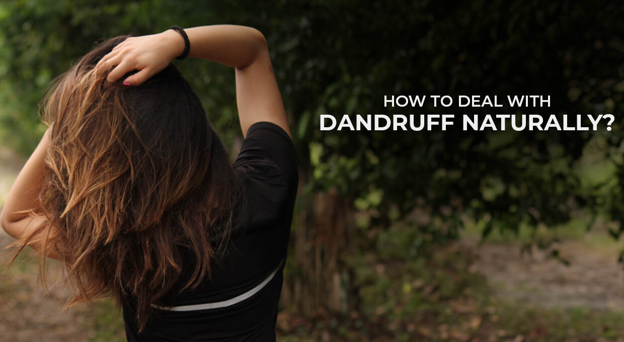 Deal with Dandruff Naturally